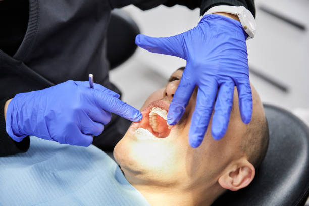 Best Emergency Wisdom Tooth Extraction in Eagleton Village, TN